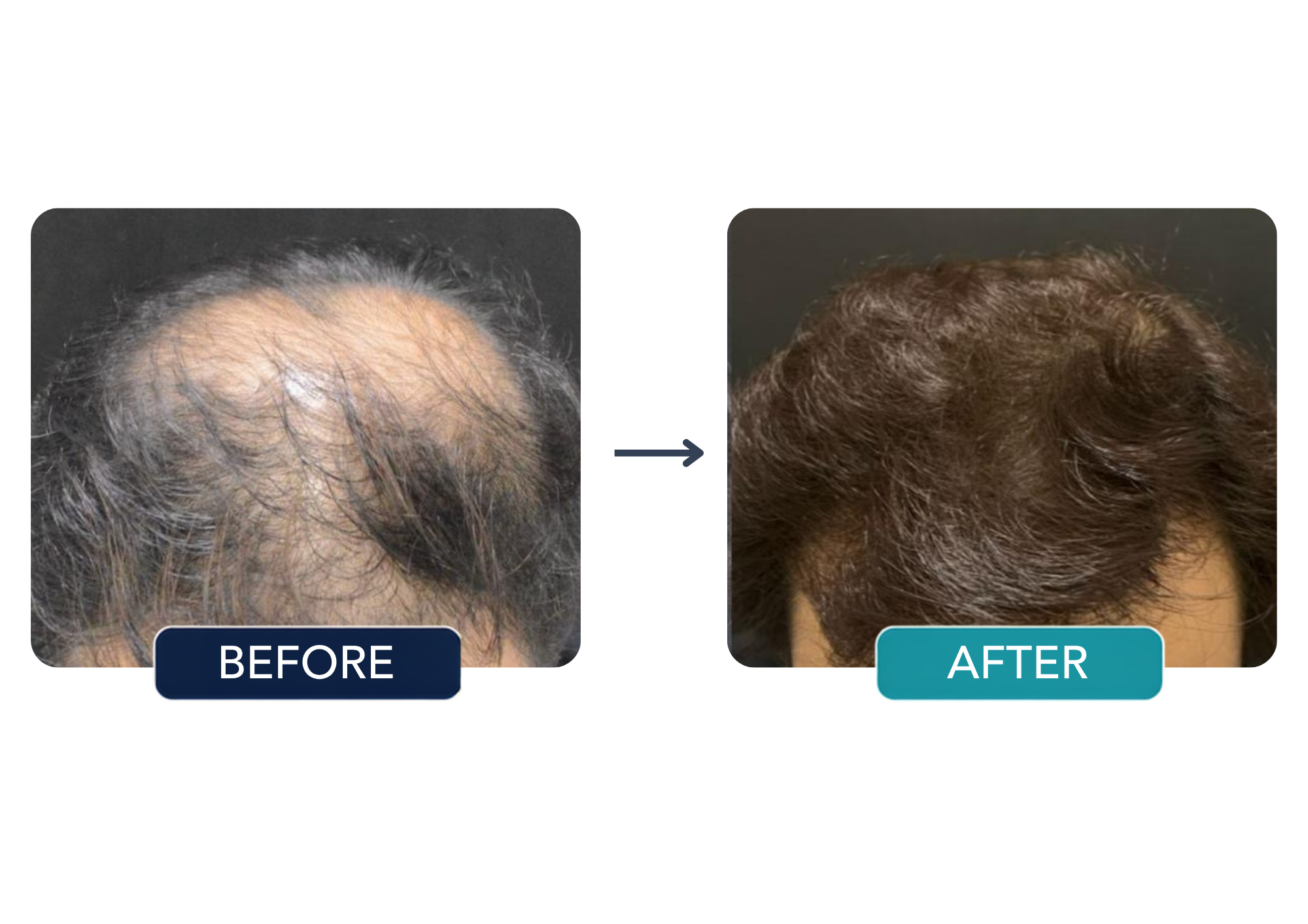 Patient comparison 1: before and after hair treatment