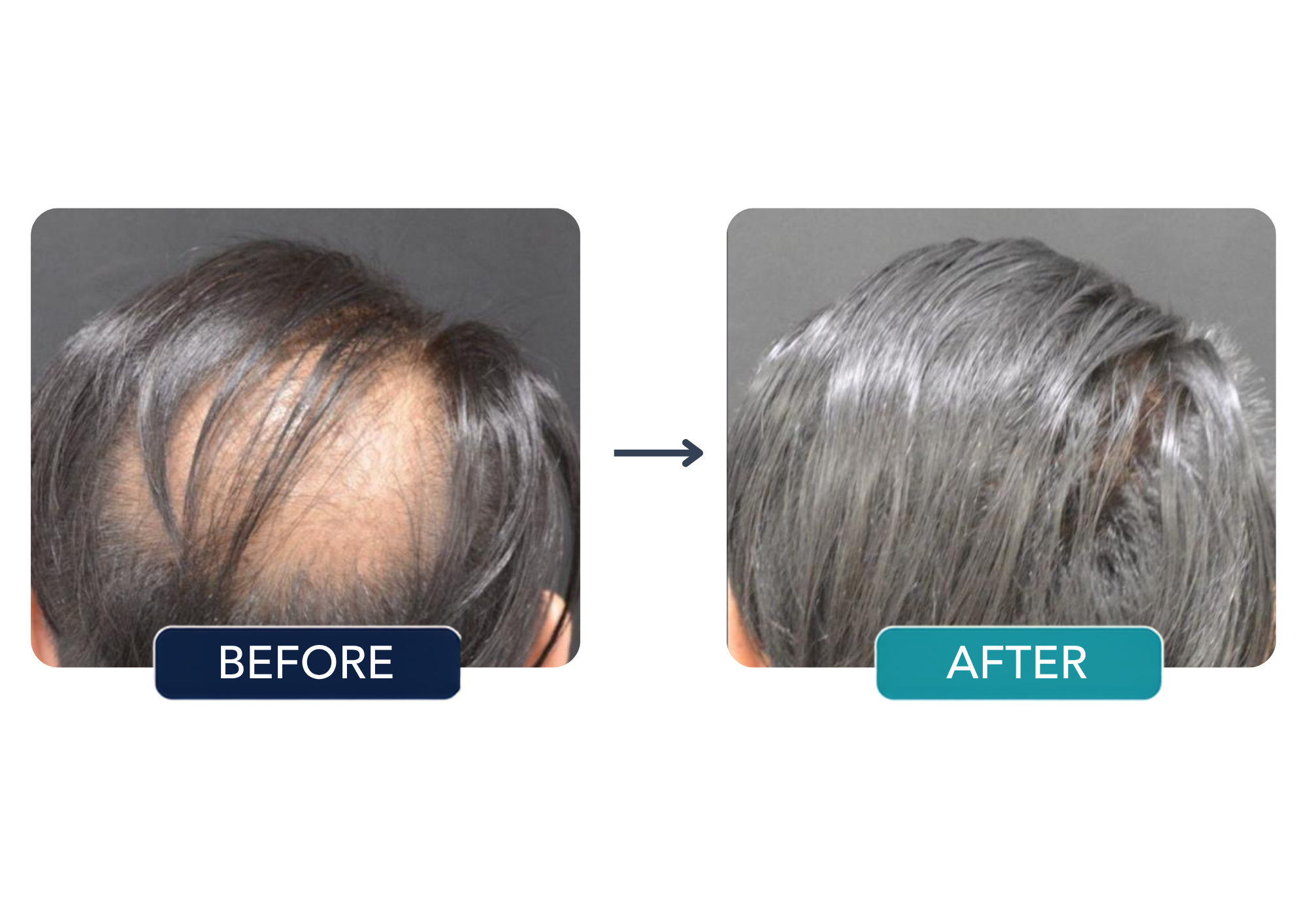 Patient comparison 2: before and after hair treatment