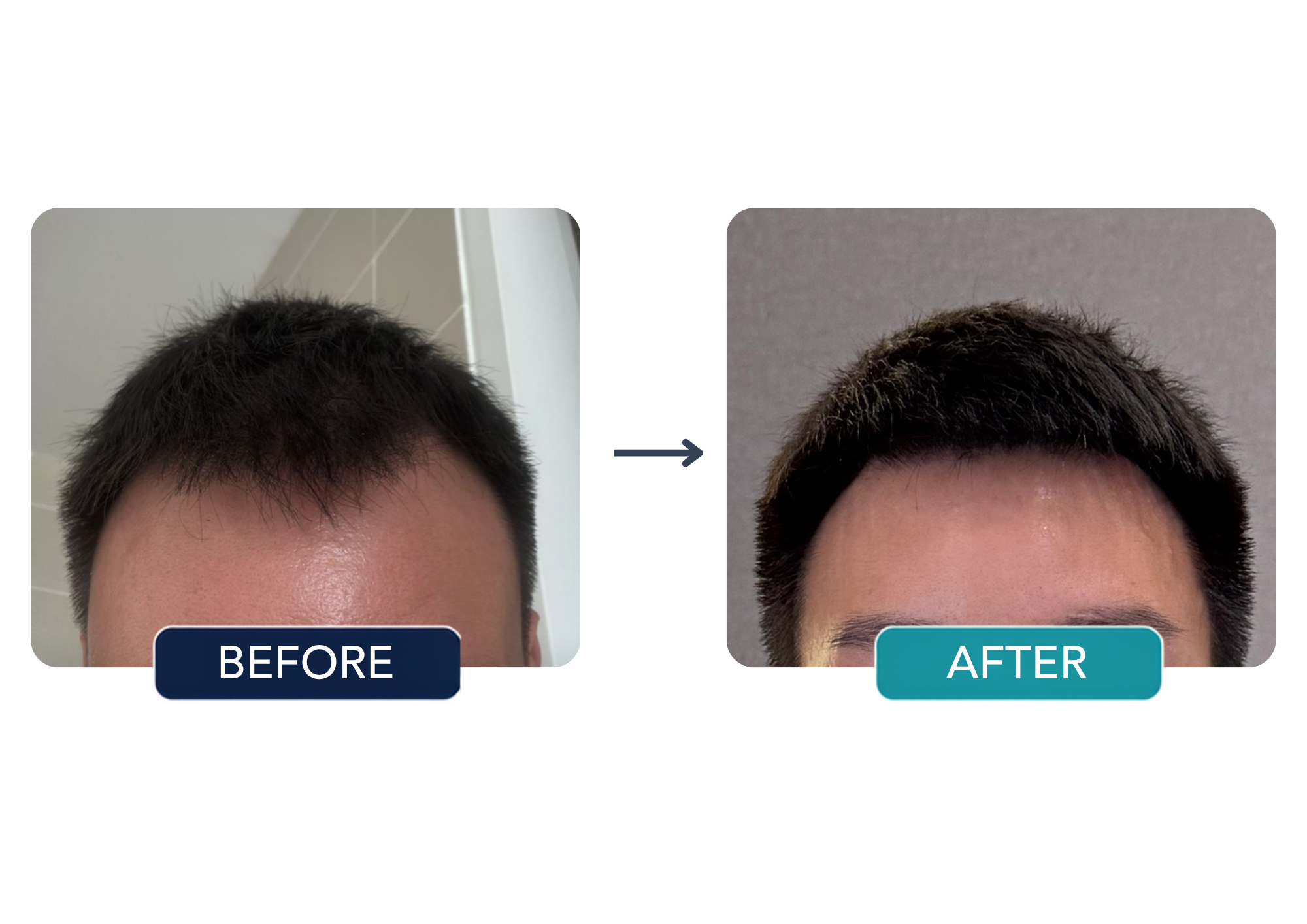 Patient comparison 3: before and after hair treatment