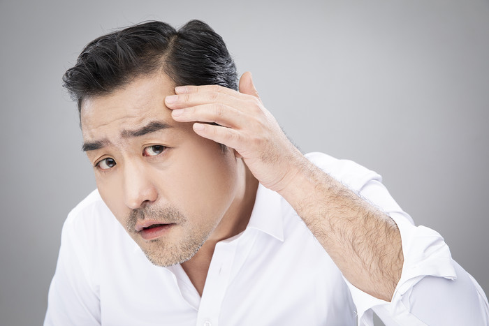 Concerned Asian man examining his receding hairline